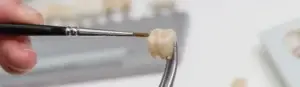 Dental crowns at Signature Smiles Dental Group in Milpitas CA